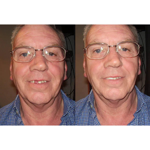 Temporary Tooth Double Kit (Save $10.80)