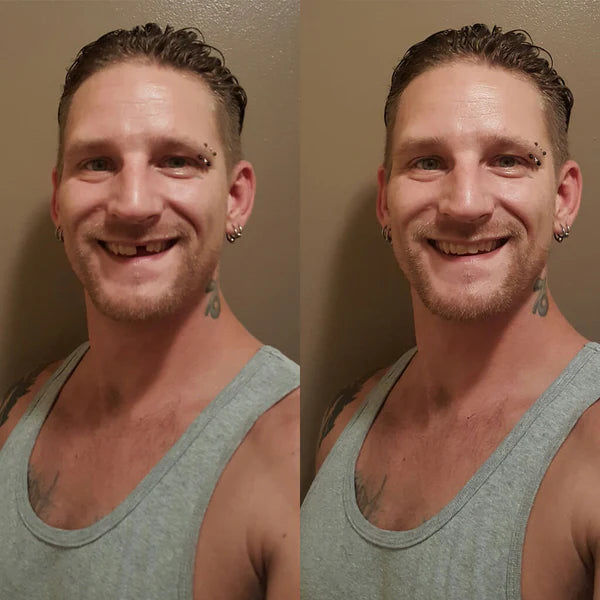 Temporary Tooth Double Kit (Save $10.80)